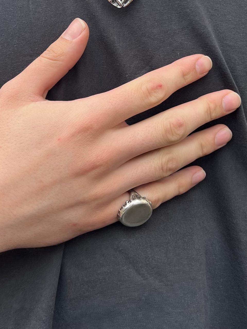 Soda Cap Ring